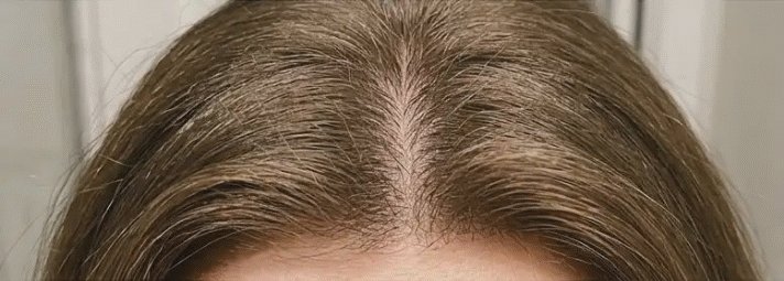 Mois 3 et au-delà avec HaloGrow